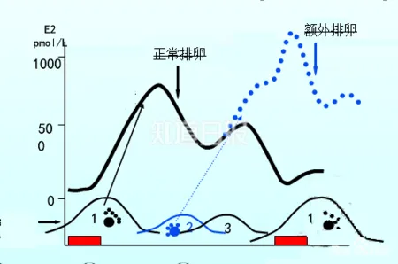 奇闻：孕妇又怀上一个孩子 咋回事儿？