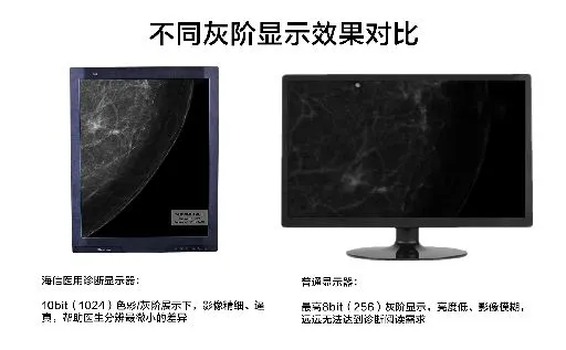 拍片检查也要共享？海信助力建设影像诊断中心实现分级诊疗