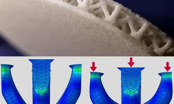 科学家在为糖尿病人开发定制化3D打印鞋垫