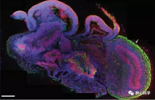 培养皿中的“大脑”：慢慢增长的智慧