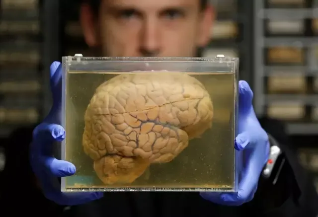 用皮肤培养一个大脑，你就能获得永生？