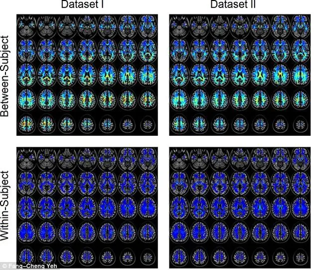 美科学家发现每个人大脑都有专属“指纹”：可精确识别身份