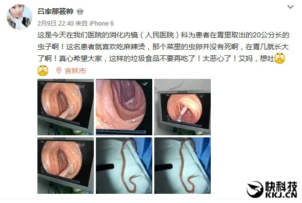 网曝吃麻辣烫胃里取出20cm虫子：真相竟是这...