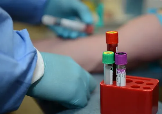 日本NCC研发新癌症检测方法：仅用一滴血就能检测出13种癌症