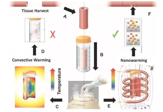 利用这种新方式来加热冷冻组织可以帮助器官短缺问题