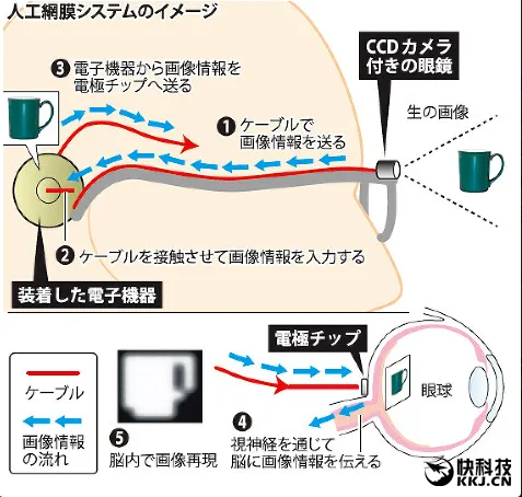 人造眼睛重要一步：人工视网膜来了