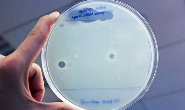 科学家从人体细菌基因组中发现两种新型抗生素