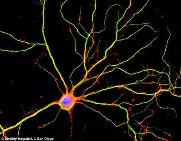 科学家解剖人类大脑：工作精细 比原预想活跃10倍