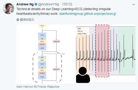 吴恩达最新动态：新公司极有可能做AI医疗