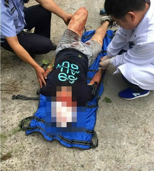 男子把共享单车当山地车骑 付出血的代价...