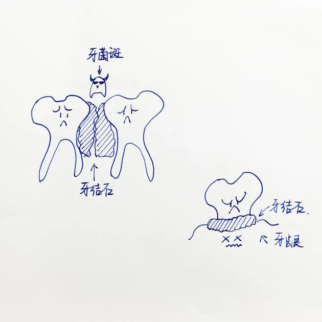 电动牙刷究竟是真的好还是商家的又一次大忽悠？