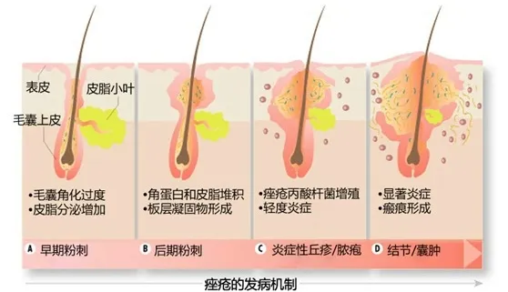 为什么北方人用手洗脸 南方却用毛巾？