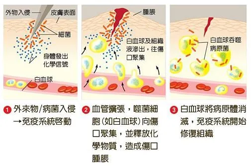 女游客出国突患脑炎去世：这是什么病？