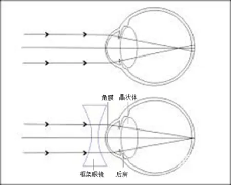 放进眼里盐水一冲视力提高三倍，这是什么鬼？