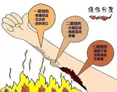 常熟火灾22人遇难：记住这9条常识能救命