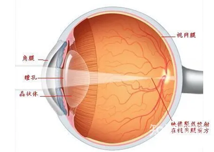 放进眼里盐水一冲视力提高三倍，这是什么鬼？