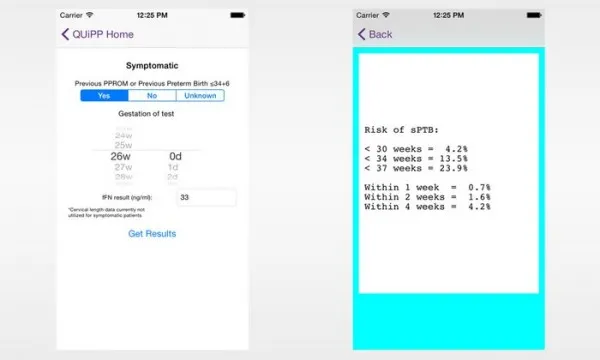 QUiPP应用可预测早产风险