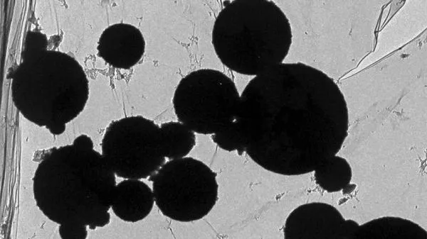 科学家证实雾霾会进入脑子? 大脑铁磁纳米粒子来自大气污染