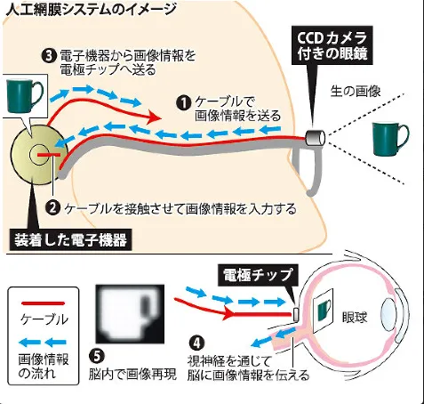 日本一教授研发“人工视网膜” 失明患者有望重见光明